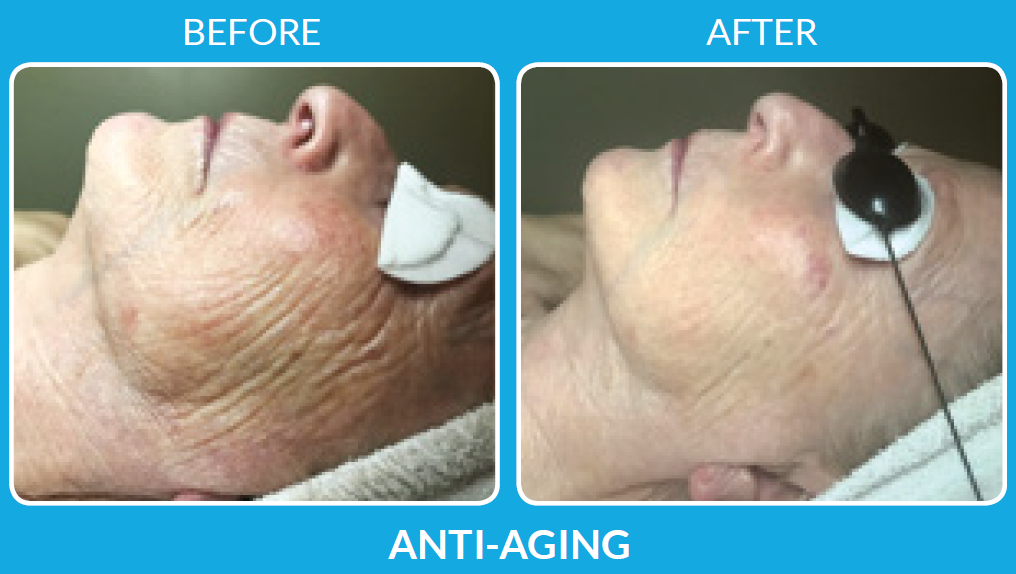 Antiaging ProCell Service Pittsburgh